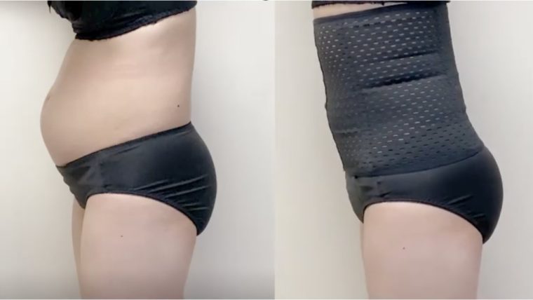 プリンセススリムビフォーアフター