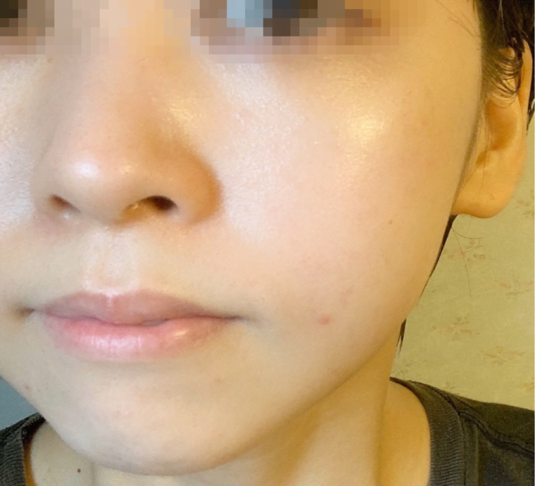 マイプリセラム　口コミ　レビュー7