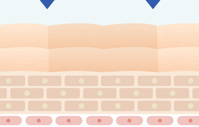 17skin(skin)炭酸ジェルパック 口コミ
