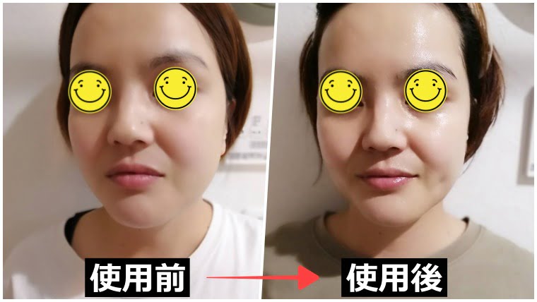 17skin(skin)炭酸ジェルパック レビュー