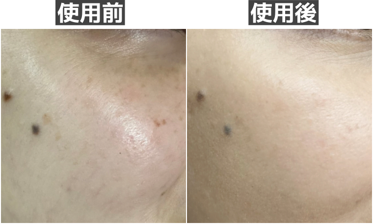 WVスキンアップファンデーション 口コミ14