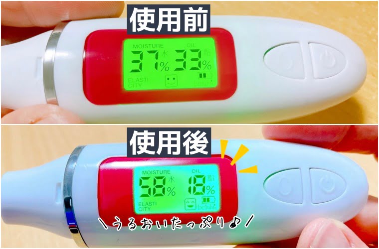 17skin アイニードル　口コミ13