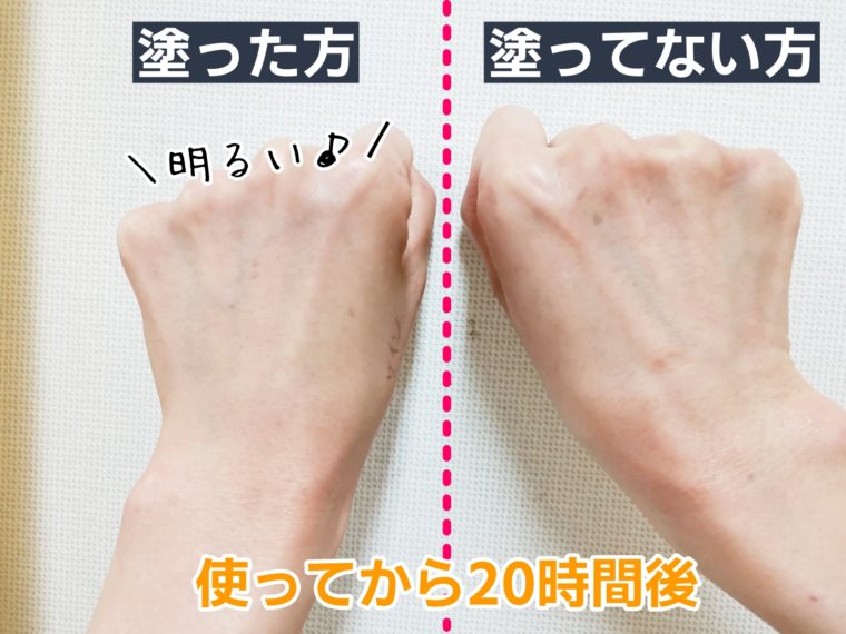 17skin アイニードル　口コミ14