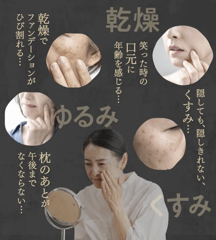 ヌーアセラム nurセラム　くすみ　乾燥　ゆるみ　悩み